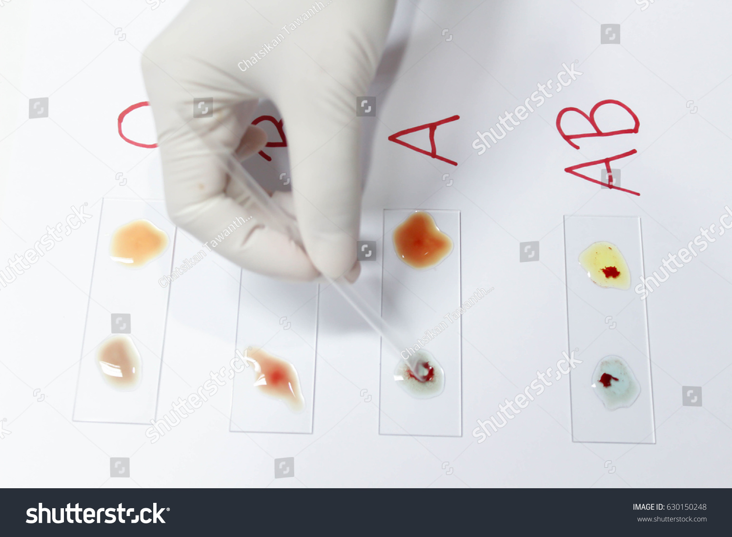 229-blood-group-slide-stock-photos-images-photography-shutterstock