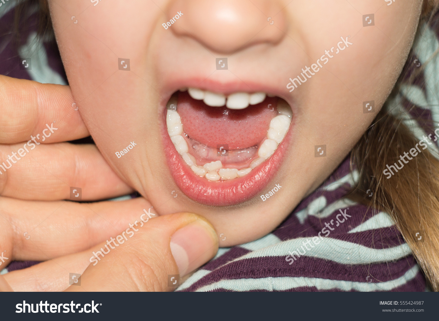 tooth coming in baby