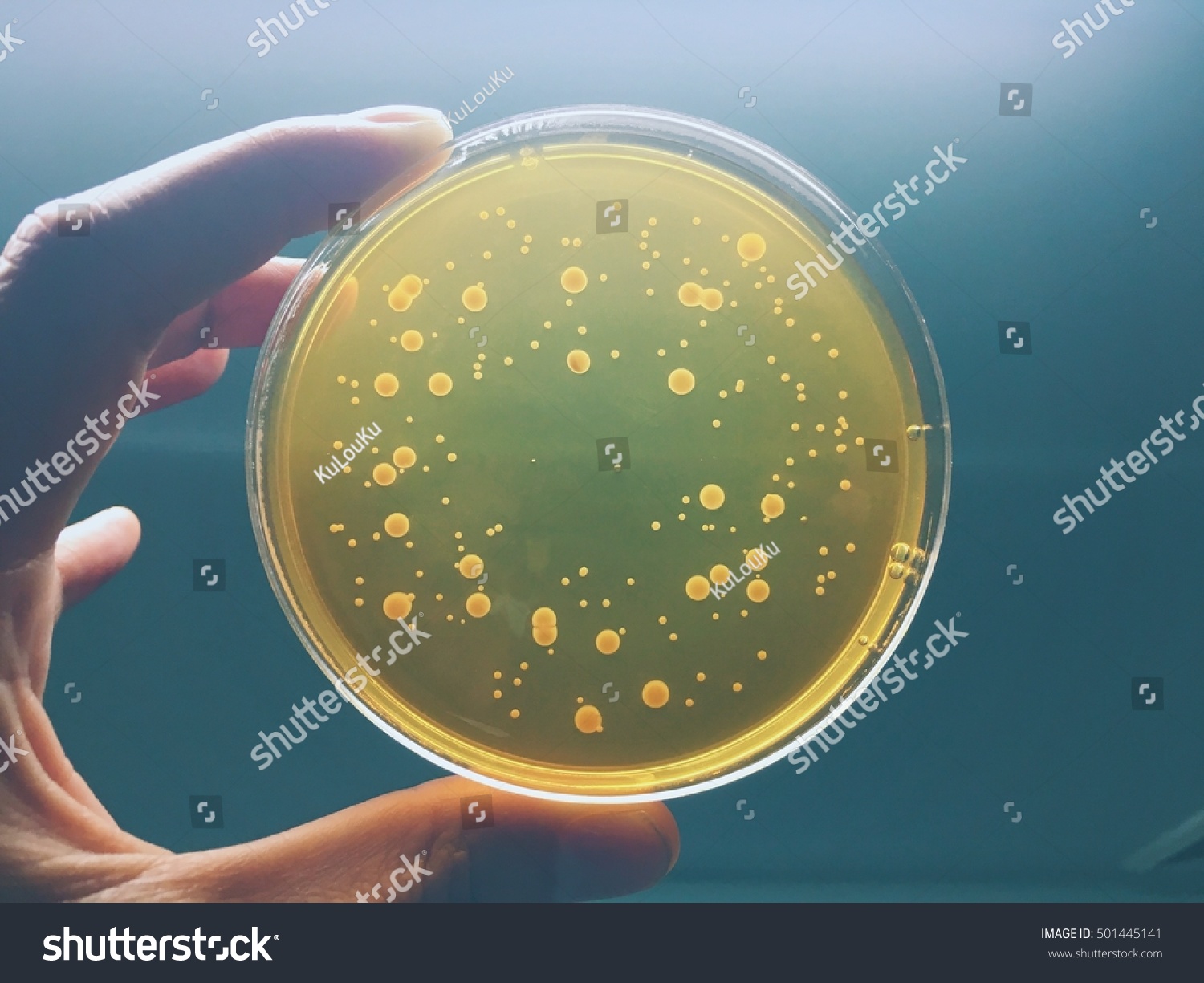 1,634 Microbiology holding agar plate Images, Stock Photos & Vectors ...