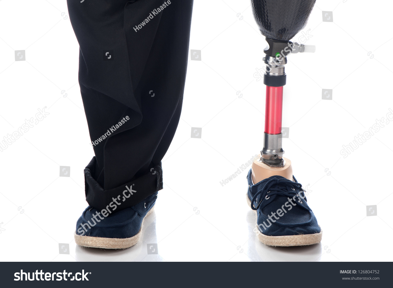 Adult Man Below Knee Amputation Stands Stock Photo 126804752 - Shutterstock