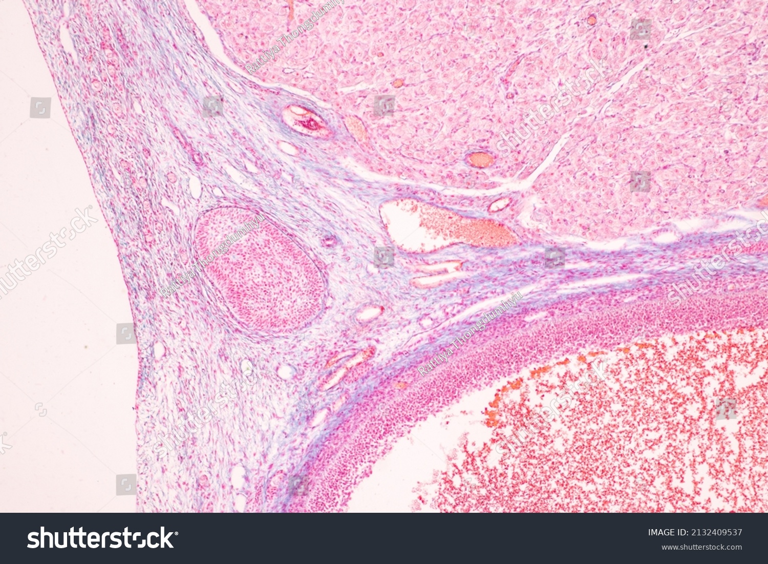 Anatomy Histological Ovary Testis Sperm Human Stock Photo (Edit Now ...