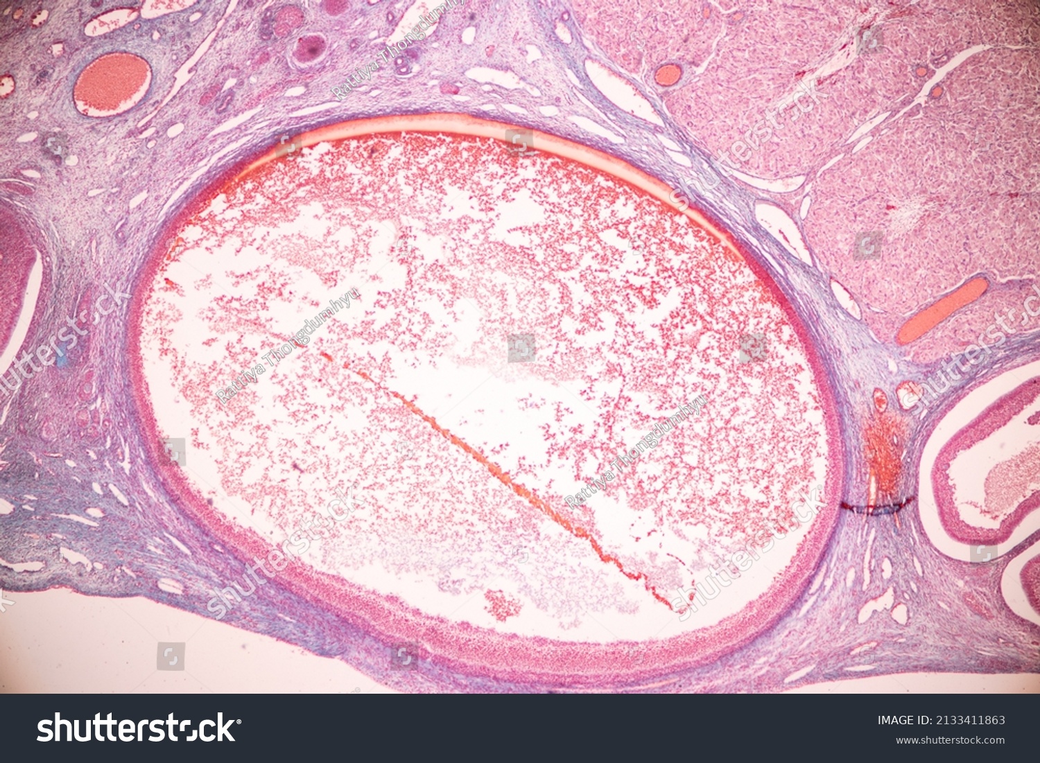 Anatomy Histological Ovary Testis Sperm Human Stock Photo 2133411863 ...