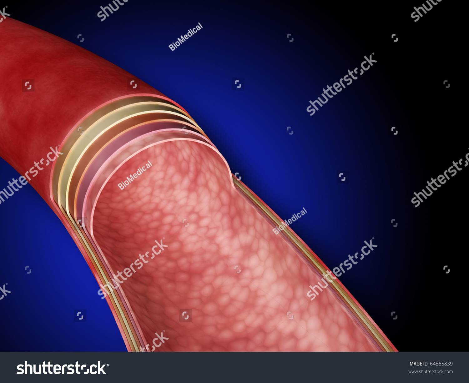 Anatomy Of An Artery, Without Labels Stock Photo 64865839 : Shutterstock