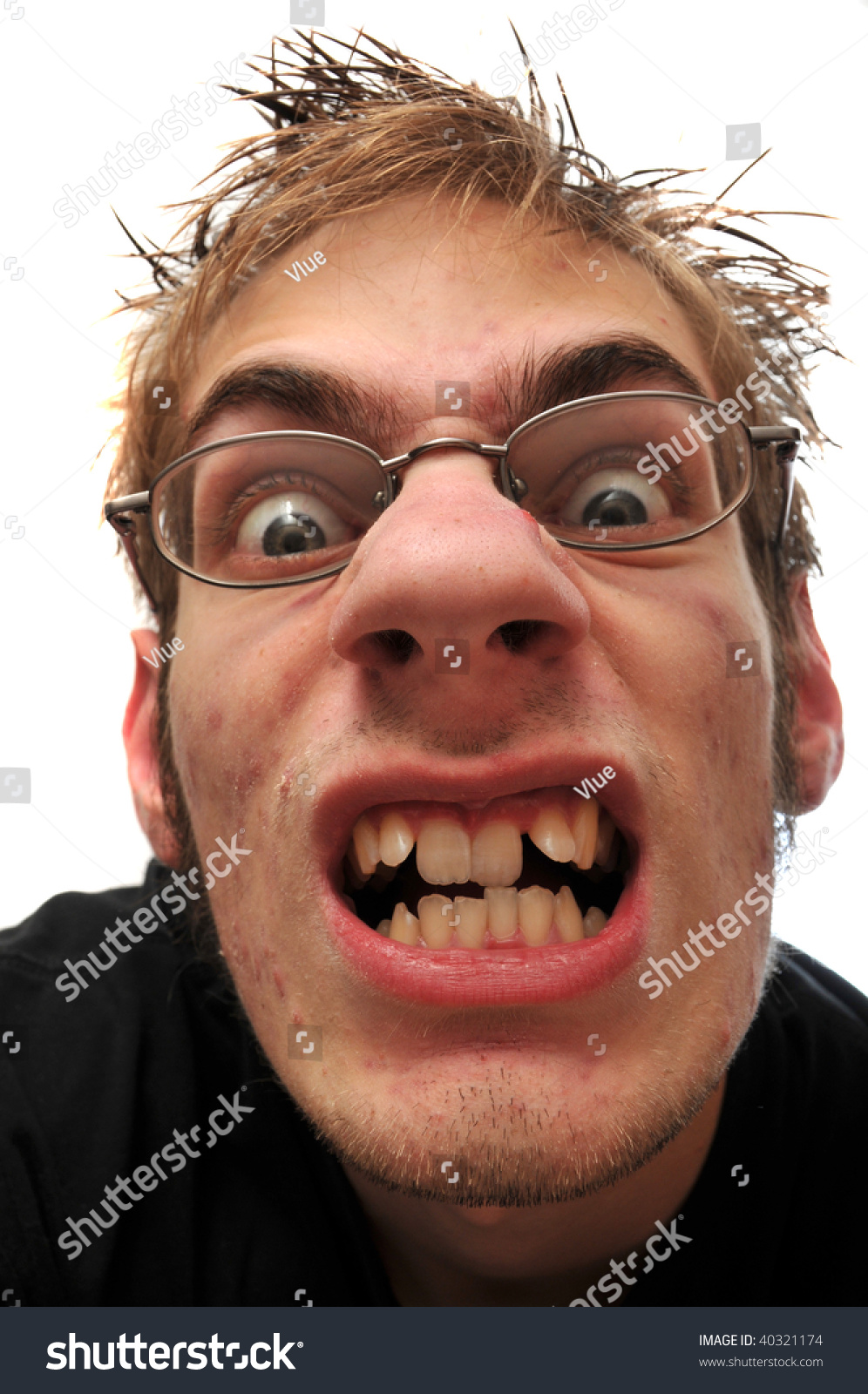 Angry Ugly Man Crooked Teeth Glasses Stock Photo 40321174 - Shutterstock