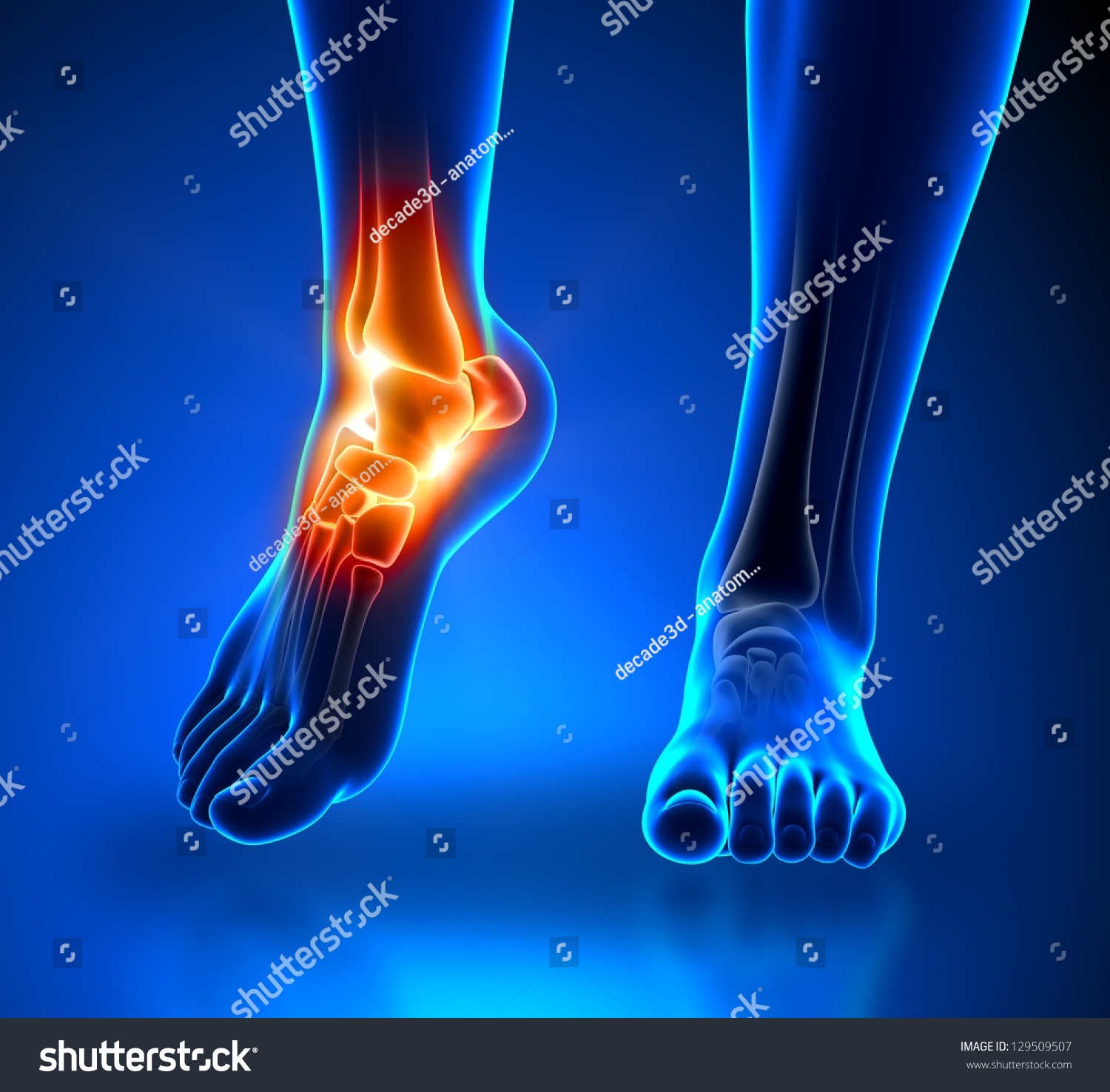 Ankle Pain Detail Anatomy Concept Stock Illustration 129509507 ...