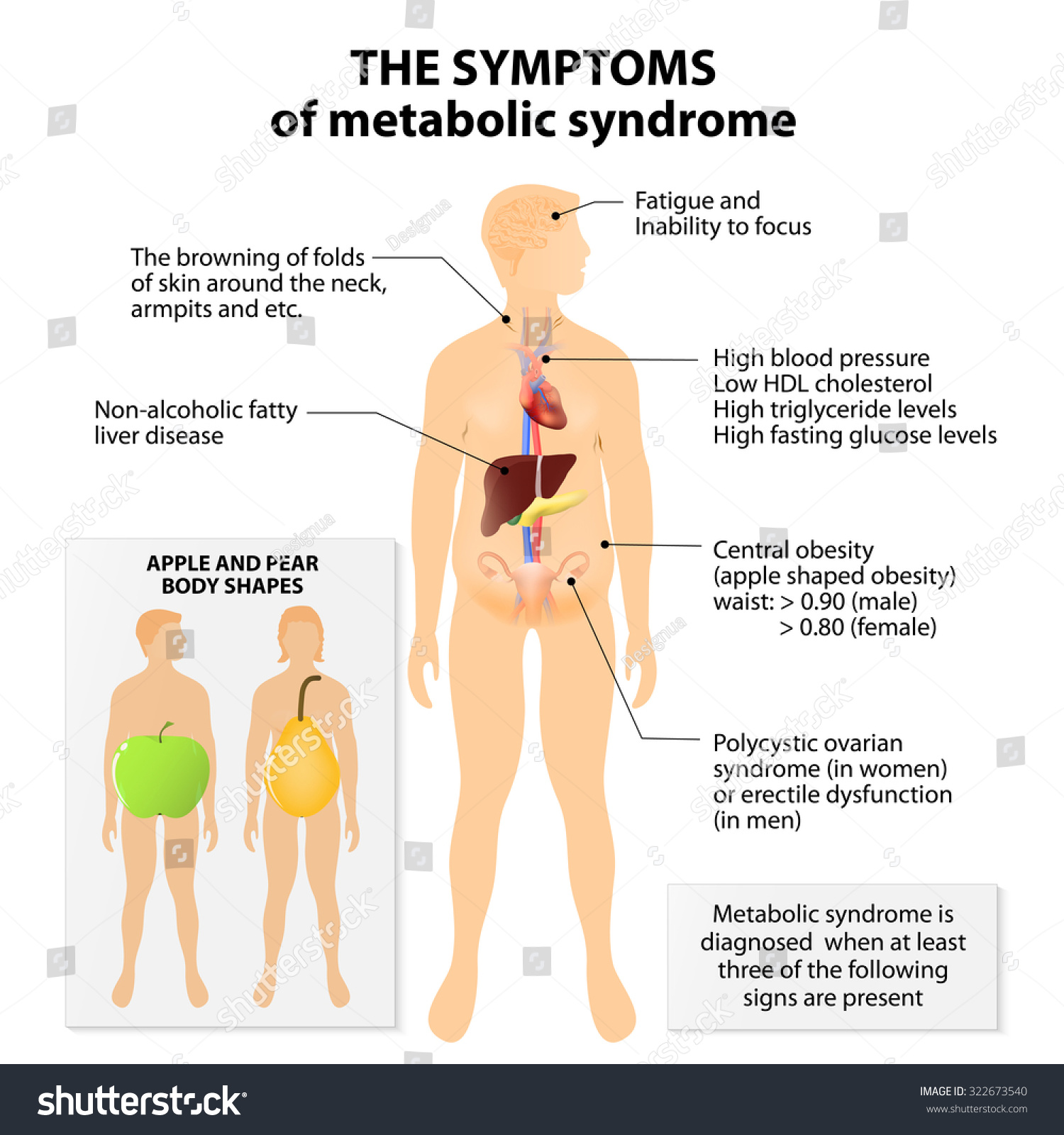 Apple Pear Body Shapes Metabolic Syndrome Stock Illustration 322673540 ...