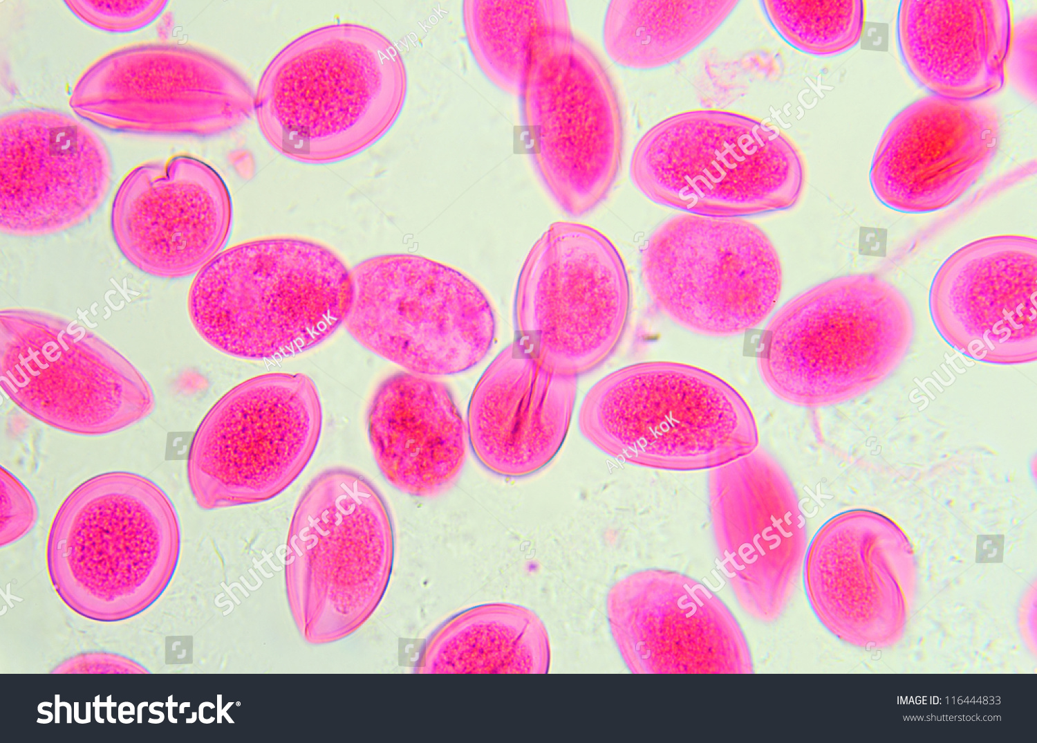 Ascaris Lumbricoides Anatomy