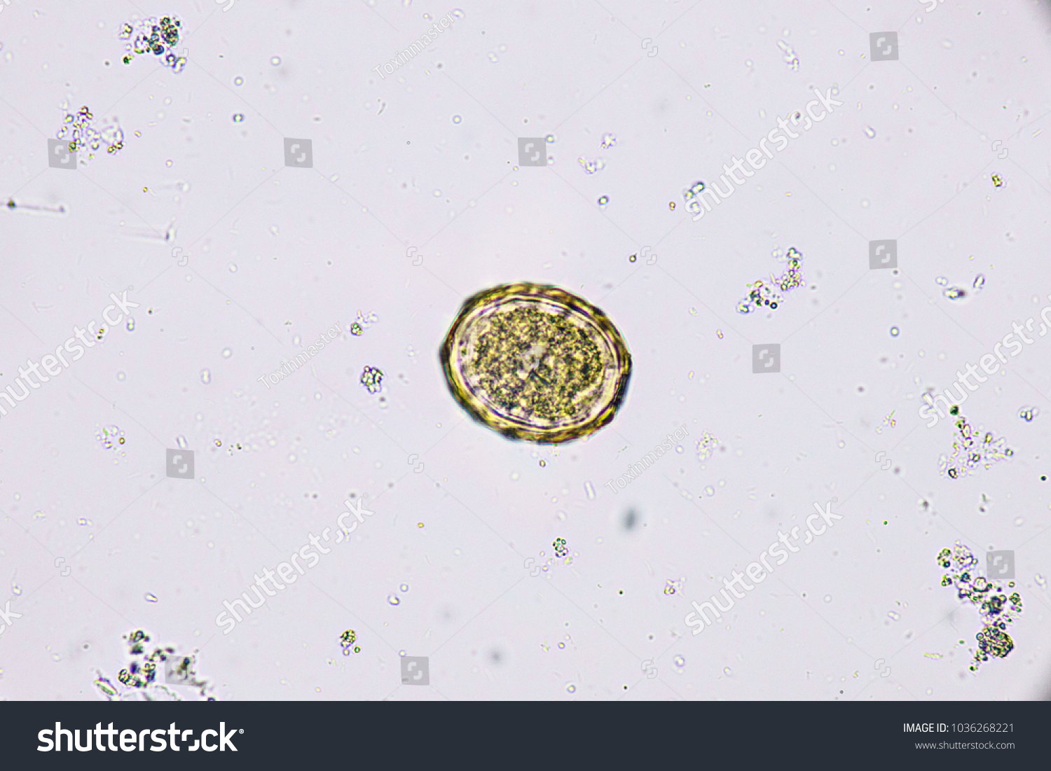 Ascaris Lumbricoides Fertilized Egg Parasite Ground Stock Photo (Edit ...