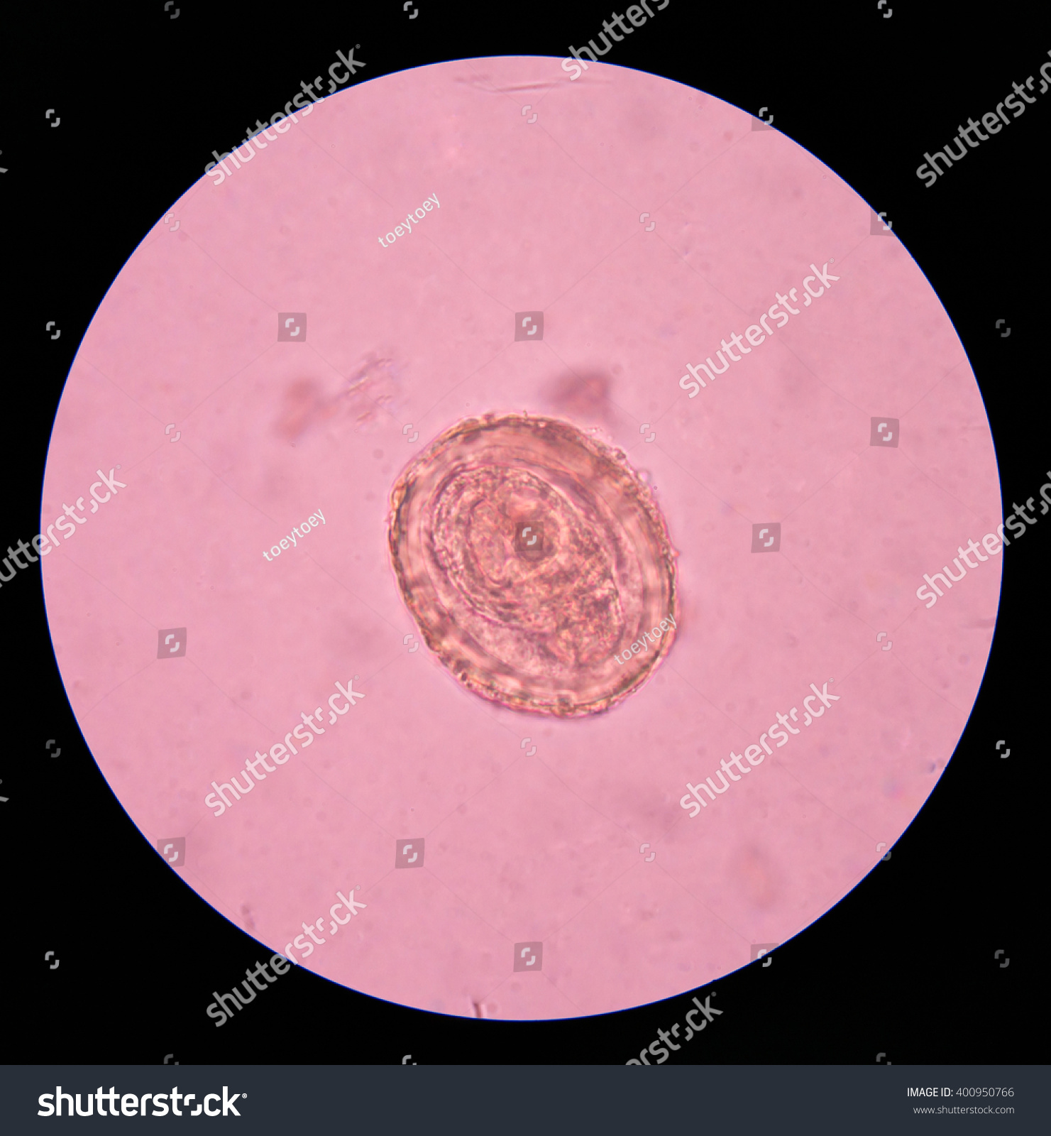 Ascaris Lumbricoides Parasite Egg Stool Exam 스톡 사진 400950766 Shutterstock 5228
