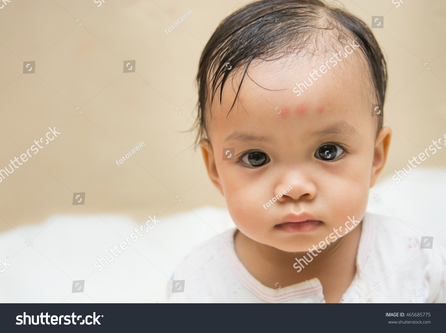 Asian Babys Forehead Brow Three Red Stock Photo 465685775 Shutterstock