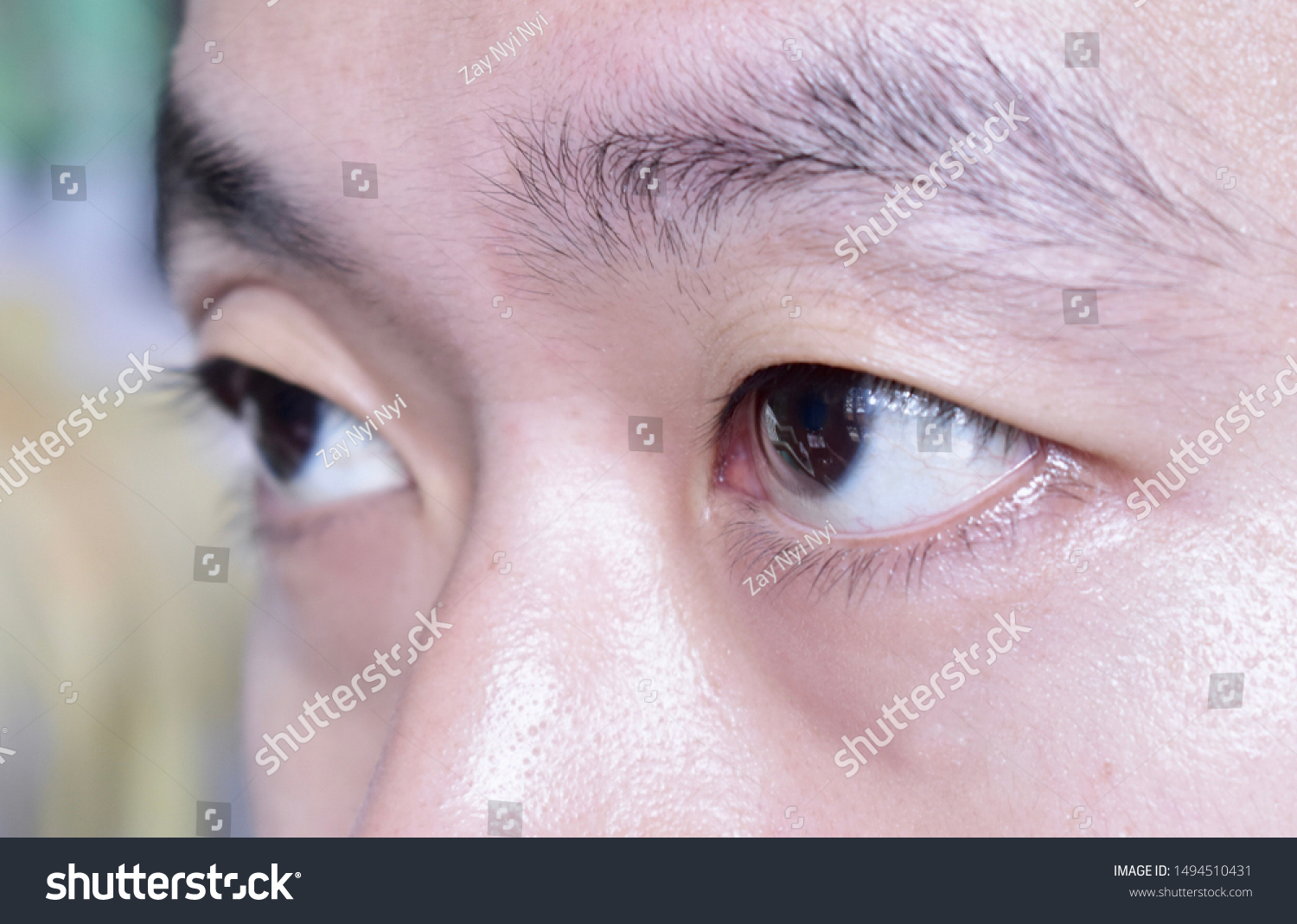 asian single eyelid