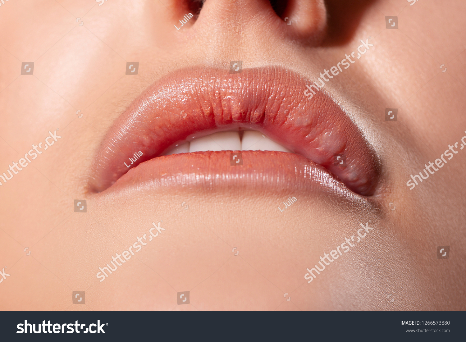 Asymmetry Lips Seals Bumps Lips After Stock Photo Edit Now 1266573880