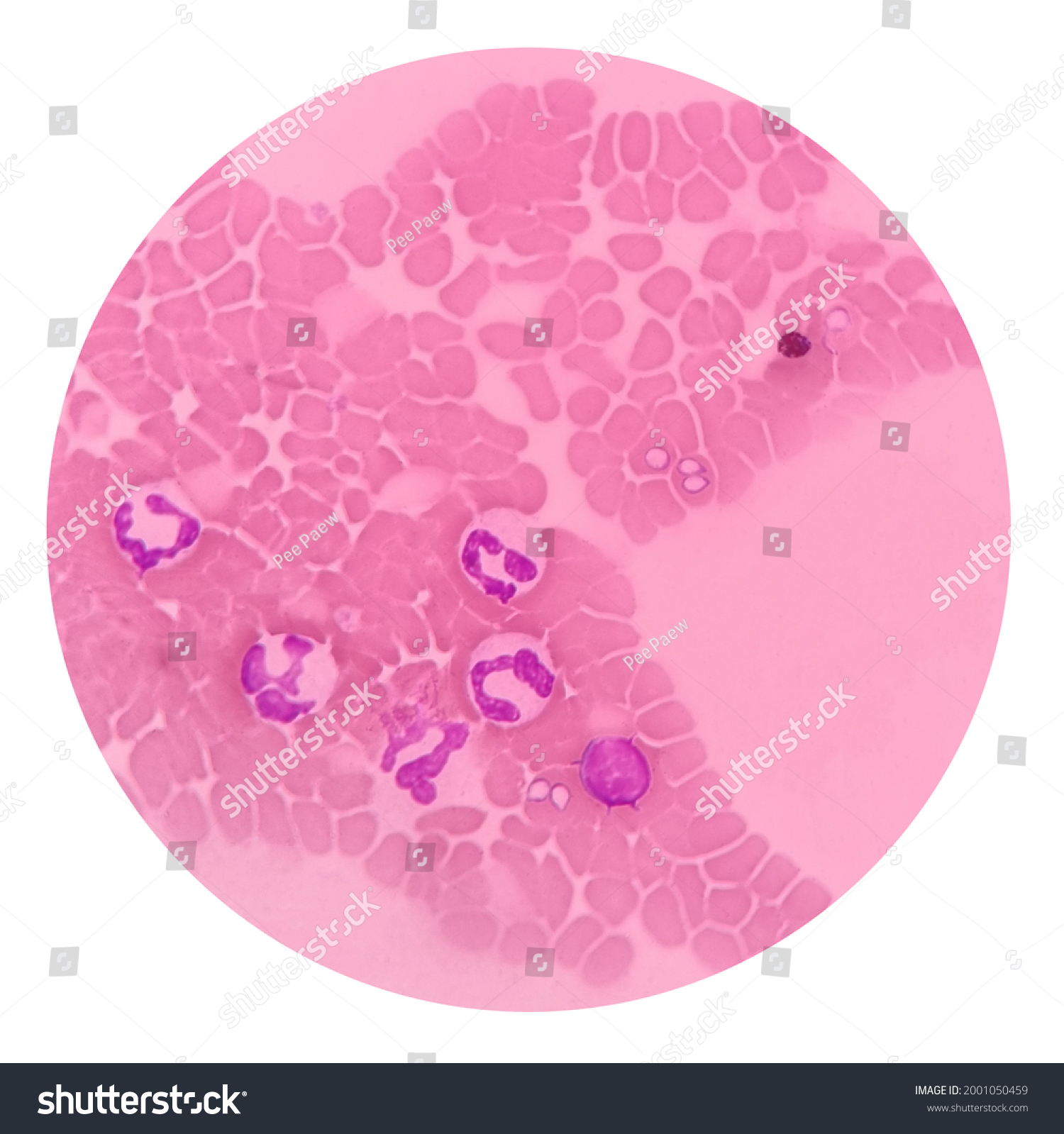 42 Babesia Canis Images, Stock Photos & Vectors | Shutterstock