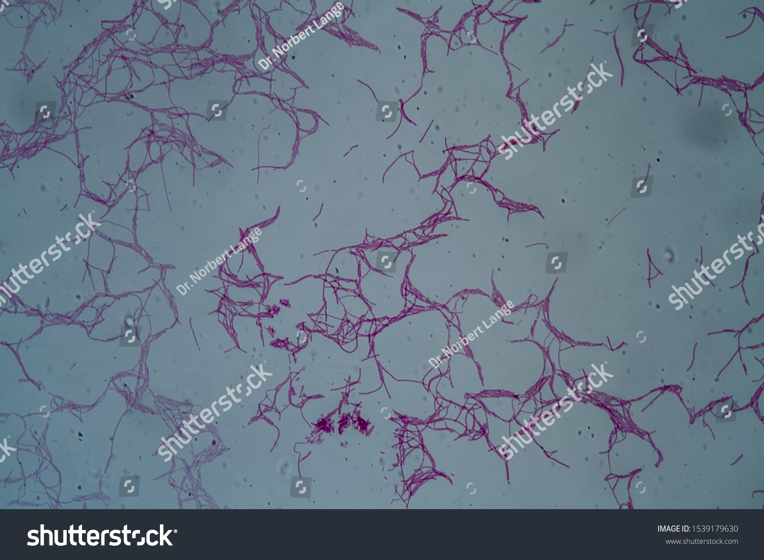 Bacillus Anthracis Anthrax Exciter Under Microscope 스톡 사진 1539179630 ...