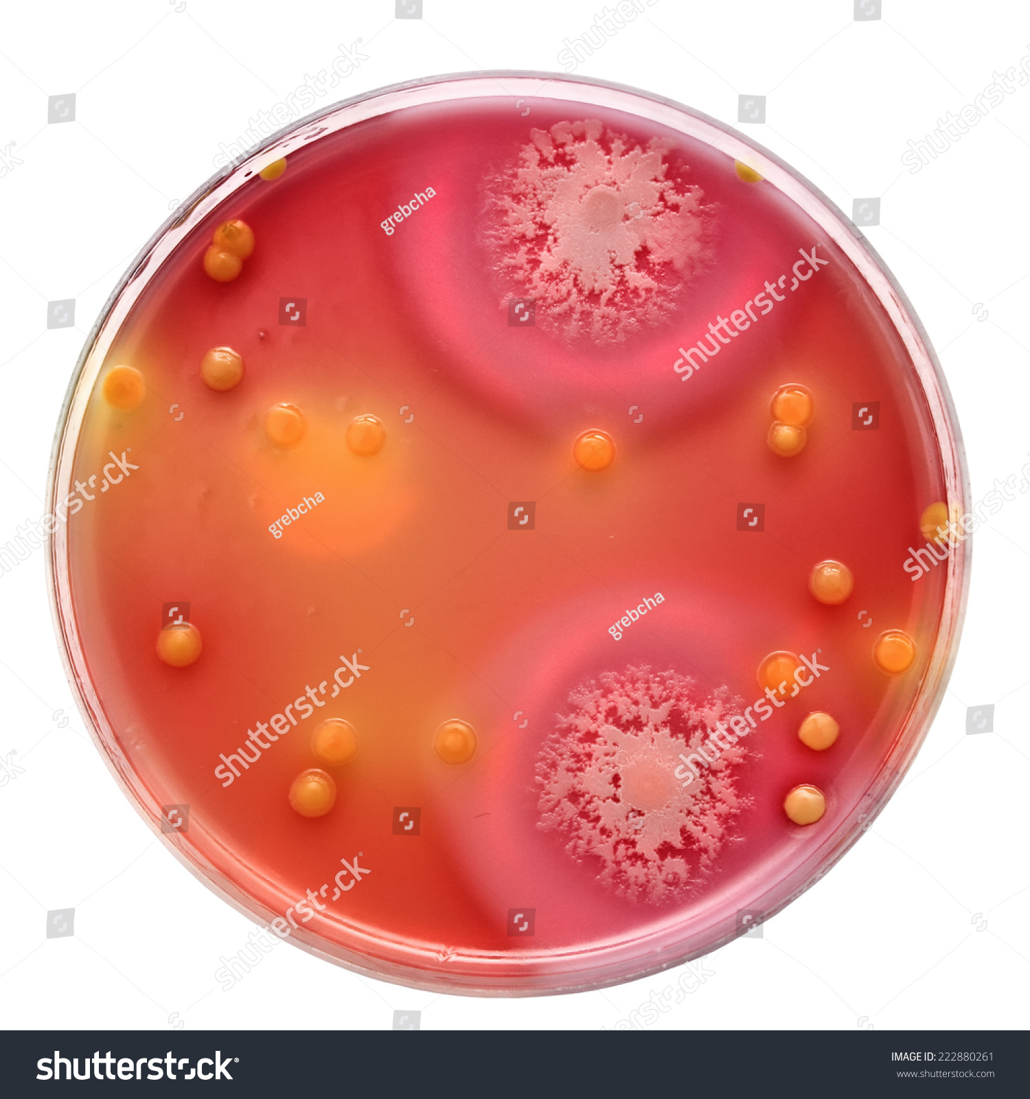 Bacillus Cereus On Petri Dish Stock Photo 222880261 | Shutterstock