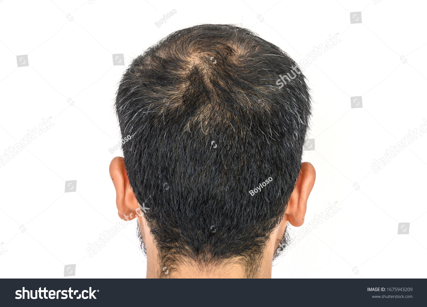 Back View Mens Head Thin Hair Stock Photo Edit Now