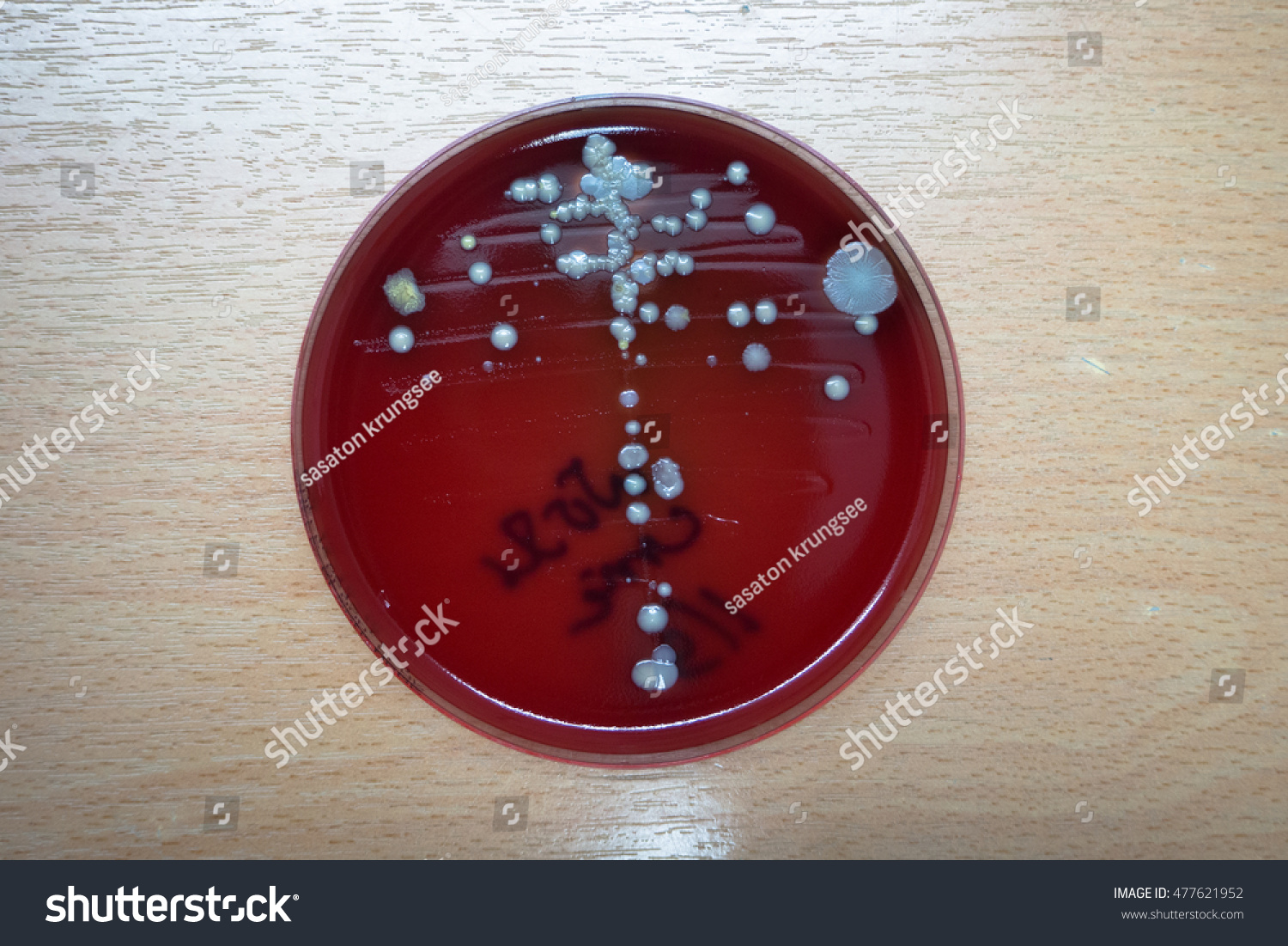 Bacteria Colonies On Blood Agar Stock Photo (Edit Now) 477621952