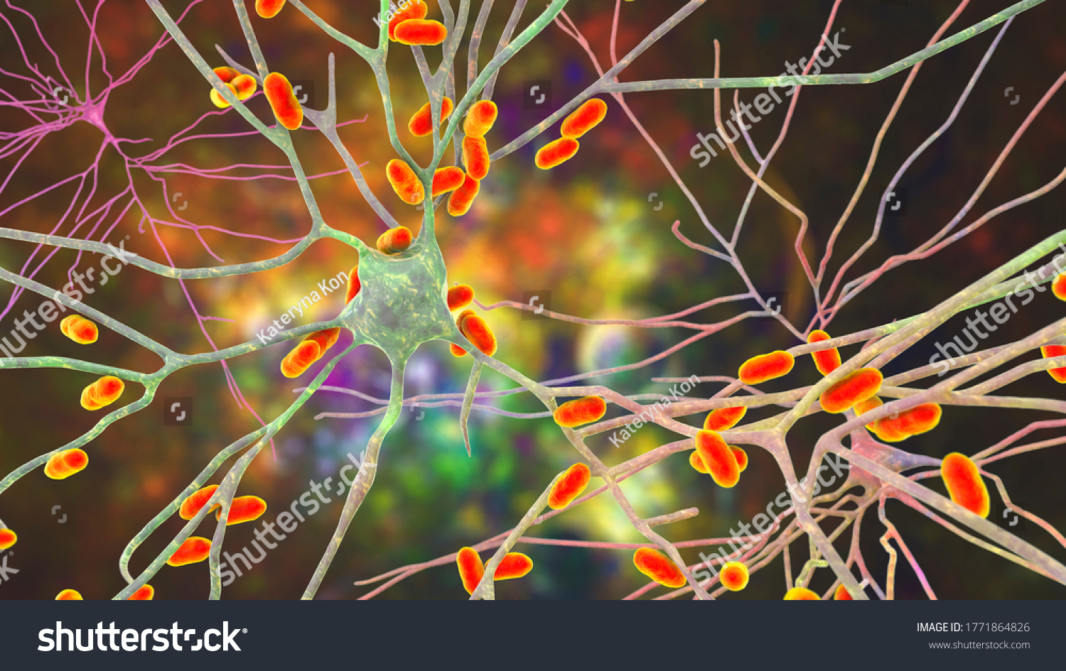 Bacteria Infecting Neurons Brain Cells 3d Stock Illustration 1771864826 ...