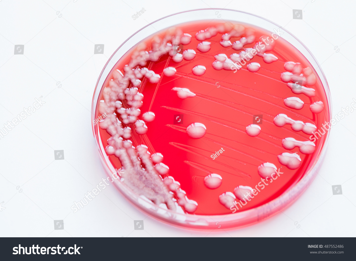 Bacterial Culture Staphylococcus Colonies Bacteria Gram Stock Photo ...