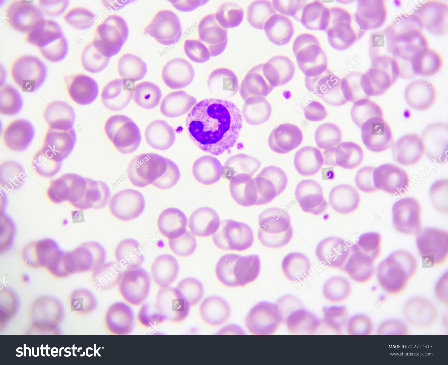 396-band-neutrophil-images-stock-photos-vectors-shutterstock