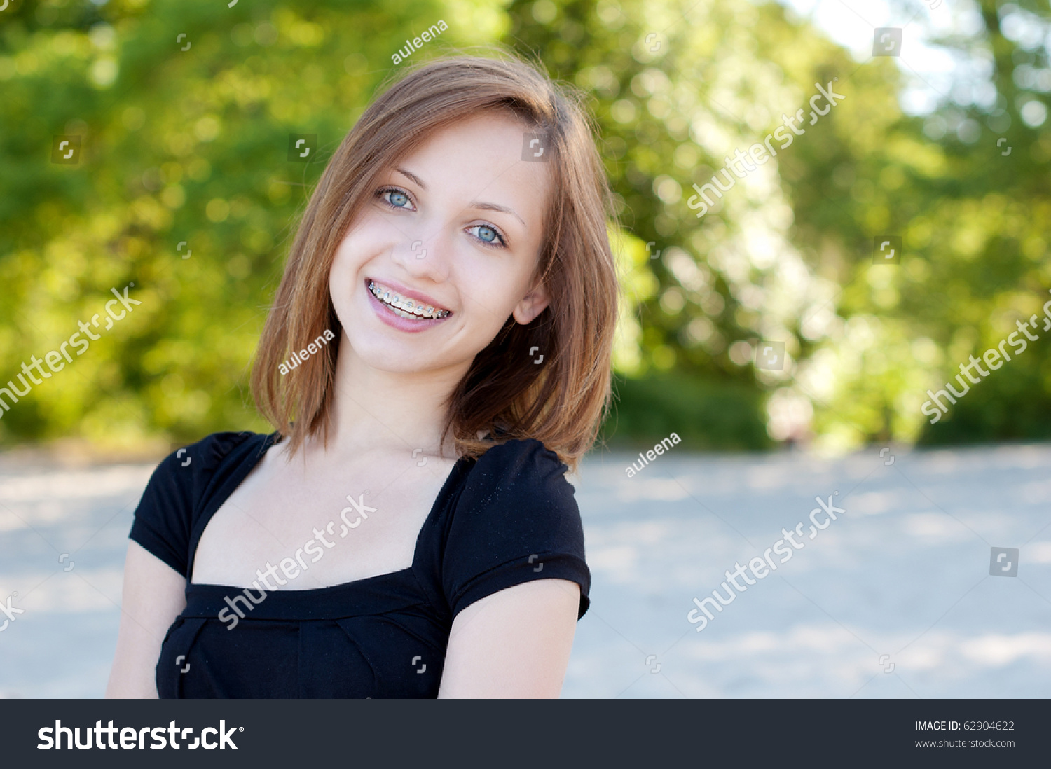 Beautiful Girl Wearing Braces, Candid Portrait Stock Photo 62904622 ...