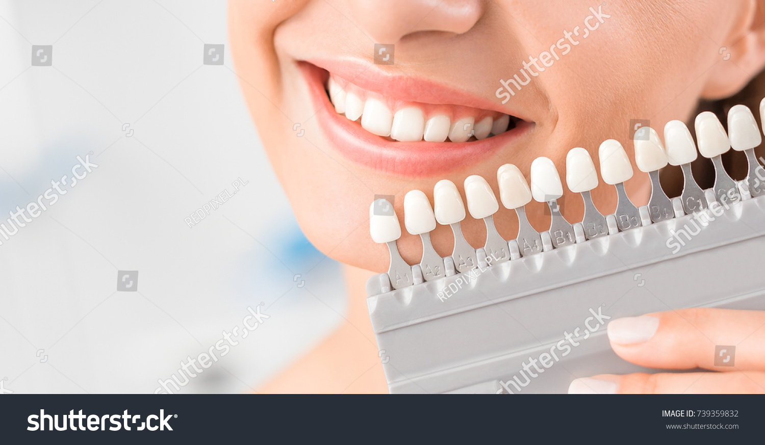Stock Photo Beautiful Smile And White Teeth Of A Young Woman Matching The Shades Of The Implants Or The 739359832 