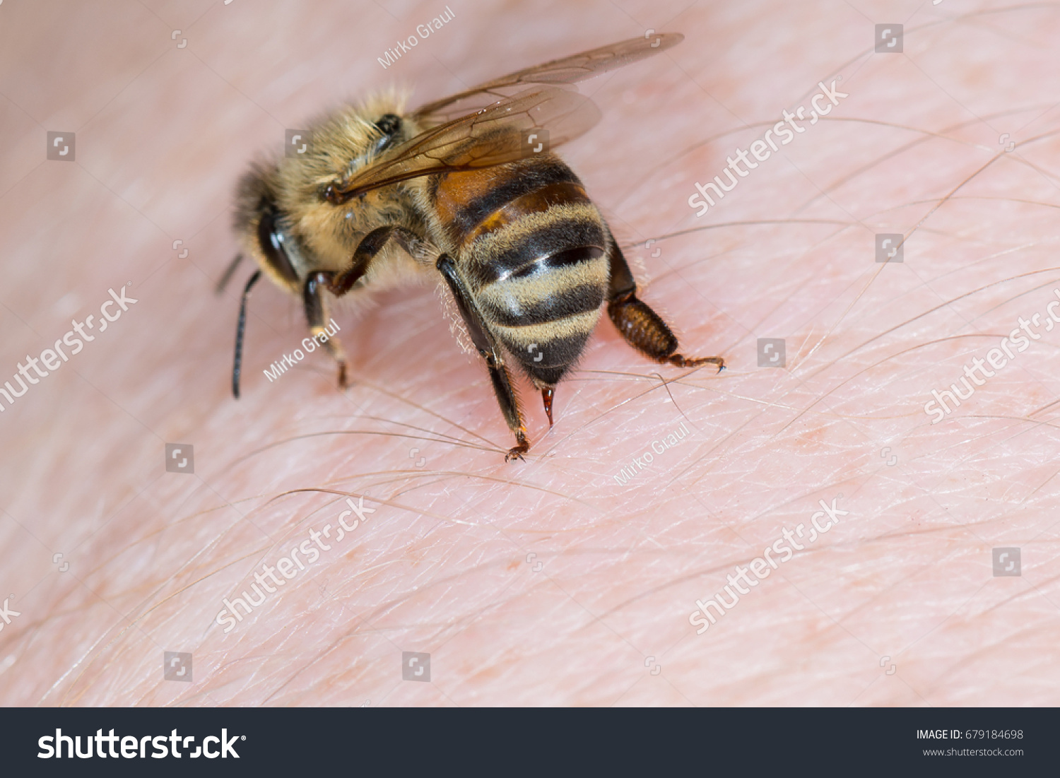 67,521 Bee sting Images, Stock Photos & Vectors | Shutterstock