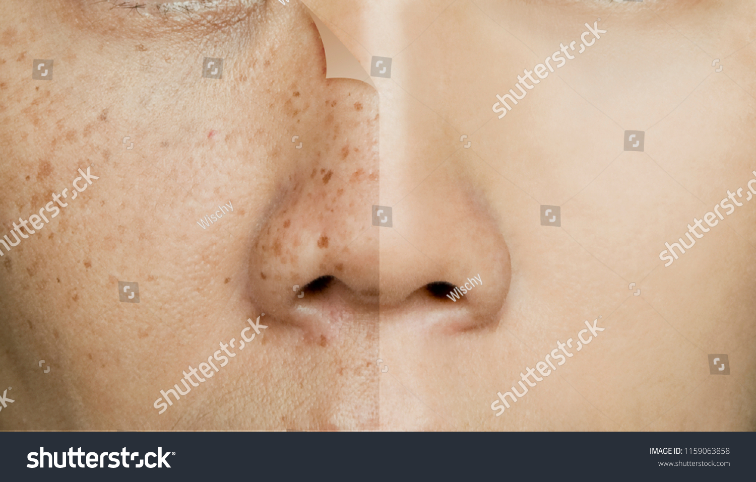 229,754 Skin spots Images, Stock Photos & Vectors | Shutterstock