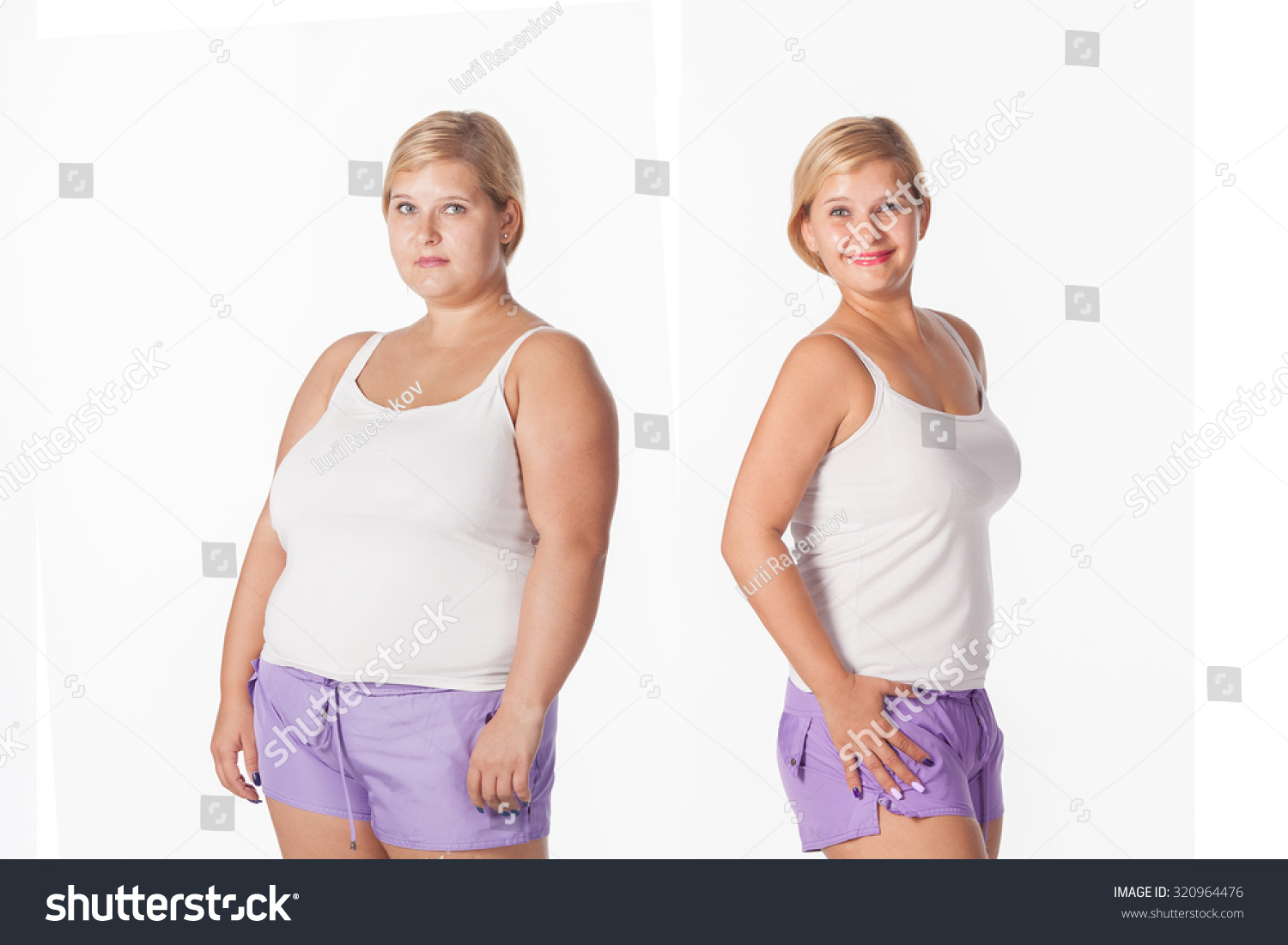 Fat To Thin Before And After 73