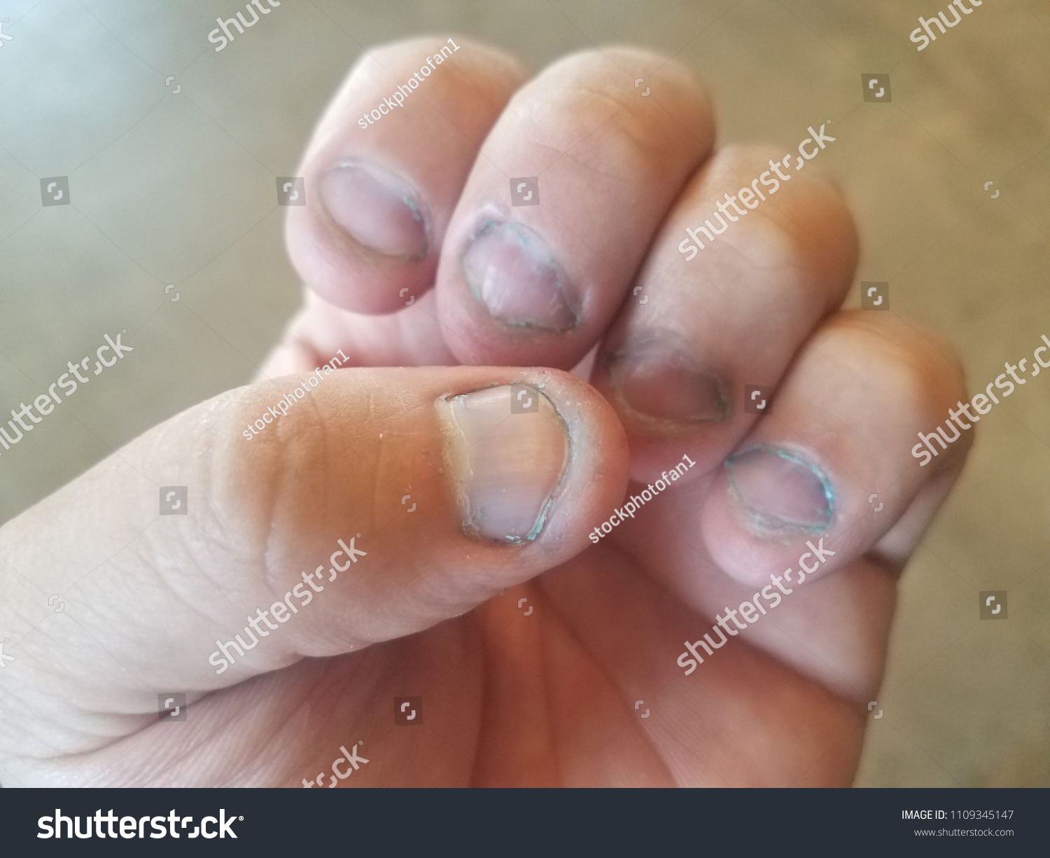 Bitten Short Dirty Fingernails Over Floor Stock Photo Edit Now
