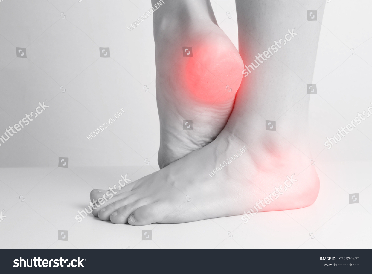 2 Osteoprosis Images, Stock Photos & Vectors | Shutterstock