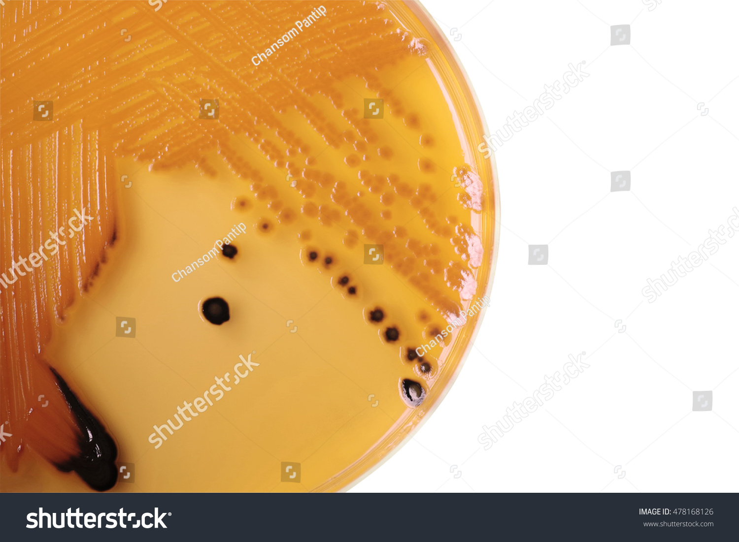 Black Bacterial Colonies Salmonella Species On Stock Photo ...