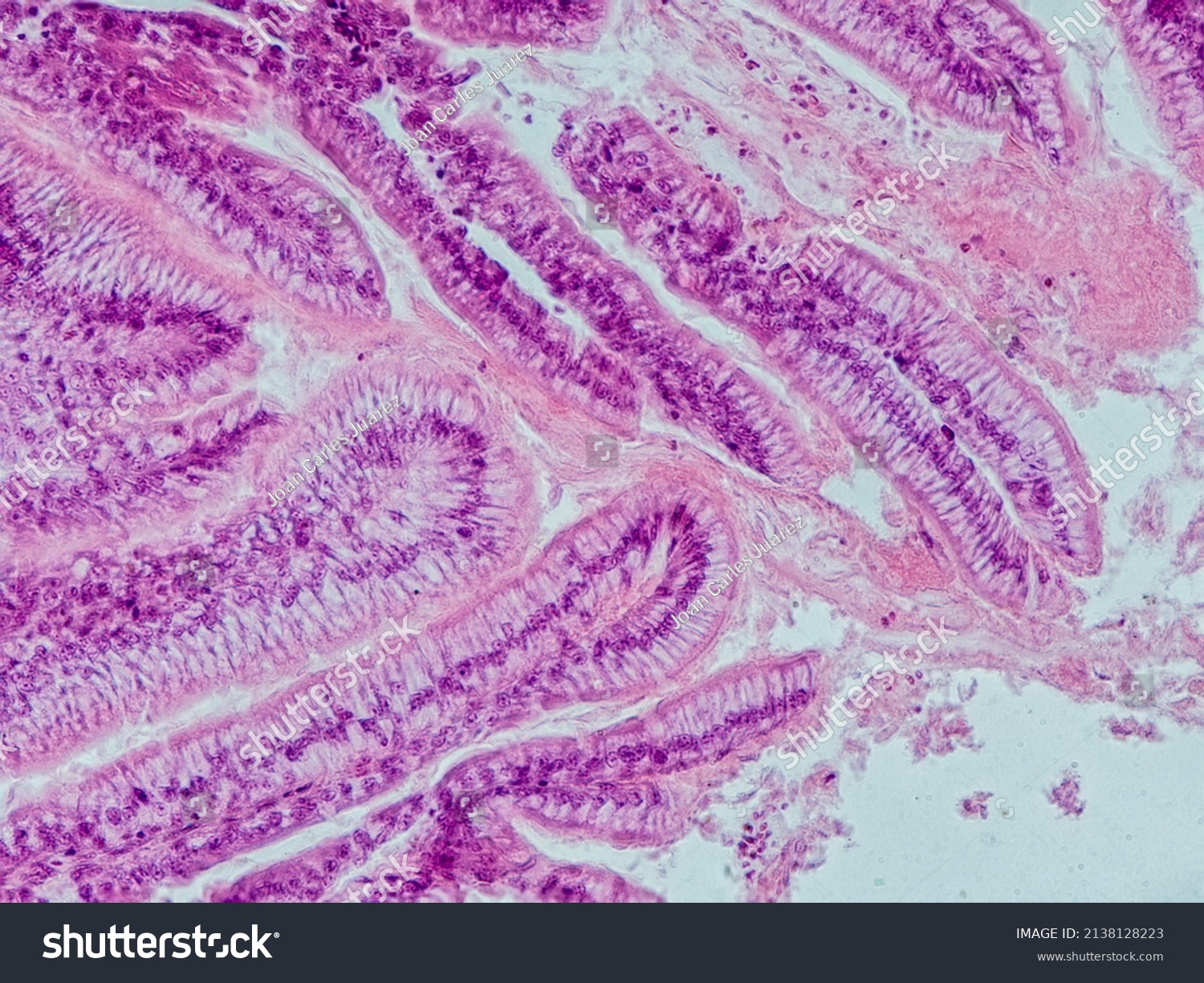 Intestinal cilia Images, Stock Photos & Vectors | Shutterstock