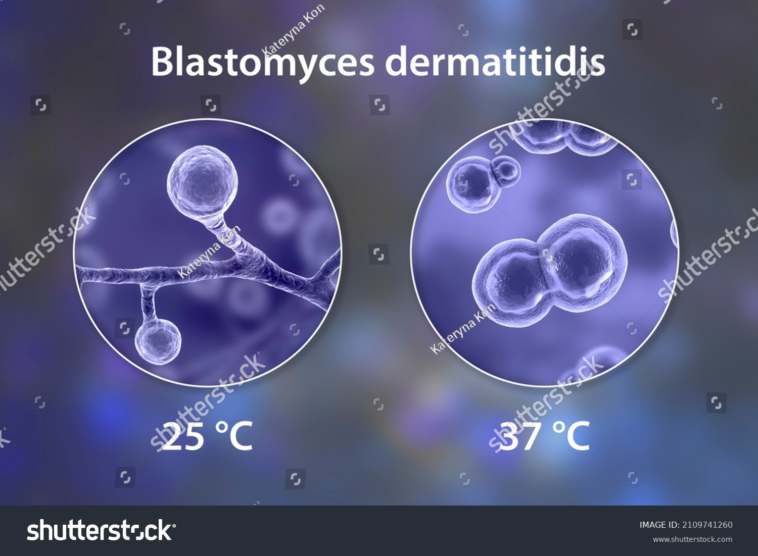 Blastomyces Dermatitidis Hongos El Agente Causante Ilustración De Stock 2109741260 Shutterstock 