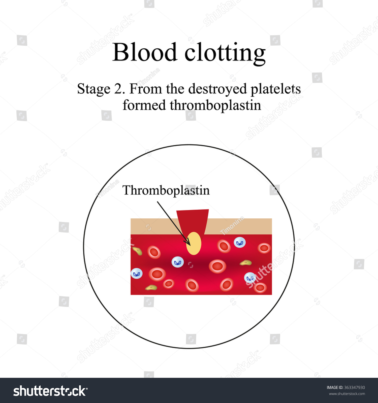 Blood Clotting Stage 2 Infographics Illustration: Ilustrações Stock ...