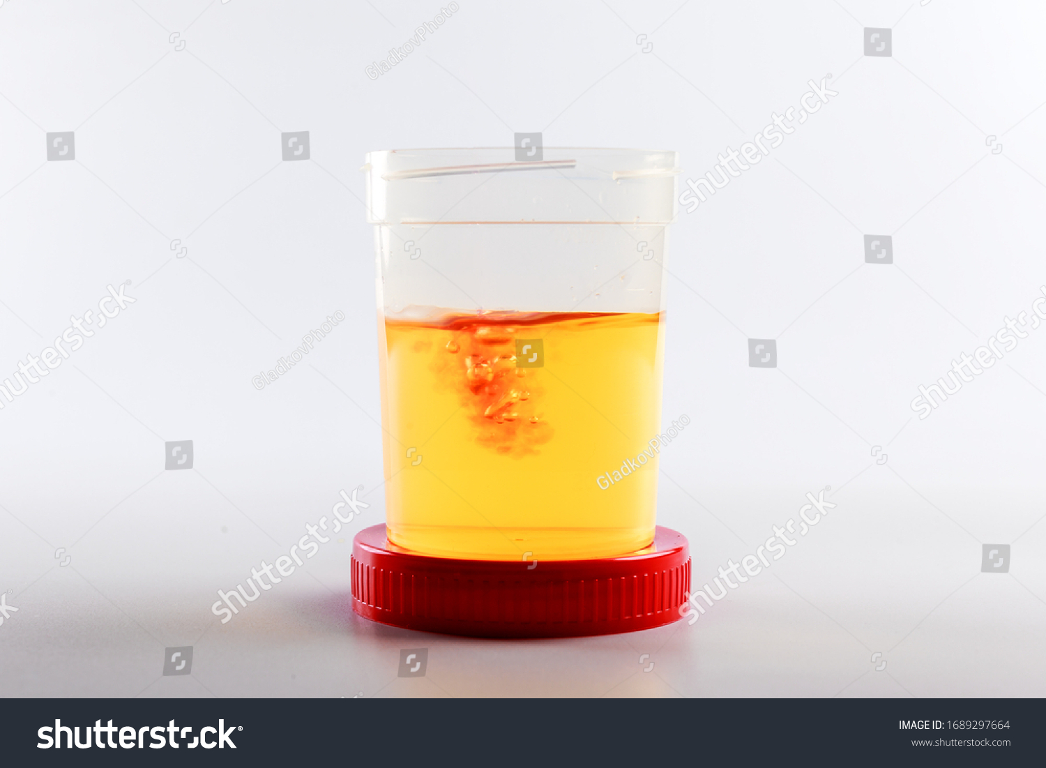 8-263-blood-in-urine-images-stock-photos-vectors-shutterstock