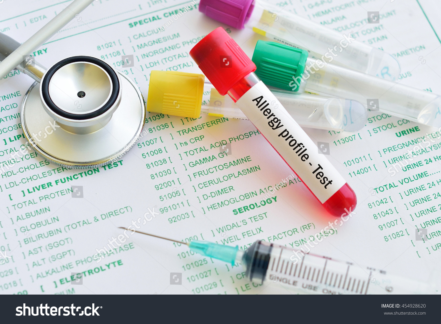 blood-sample-allergy-profile-test-stock-photo-454928620-shutterstock