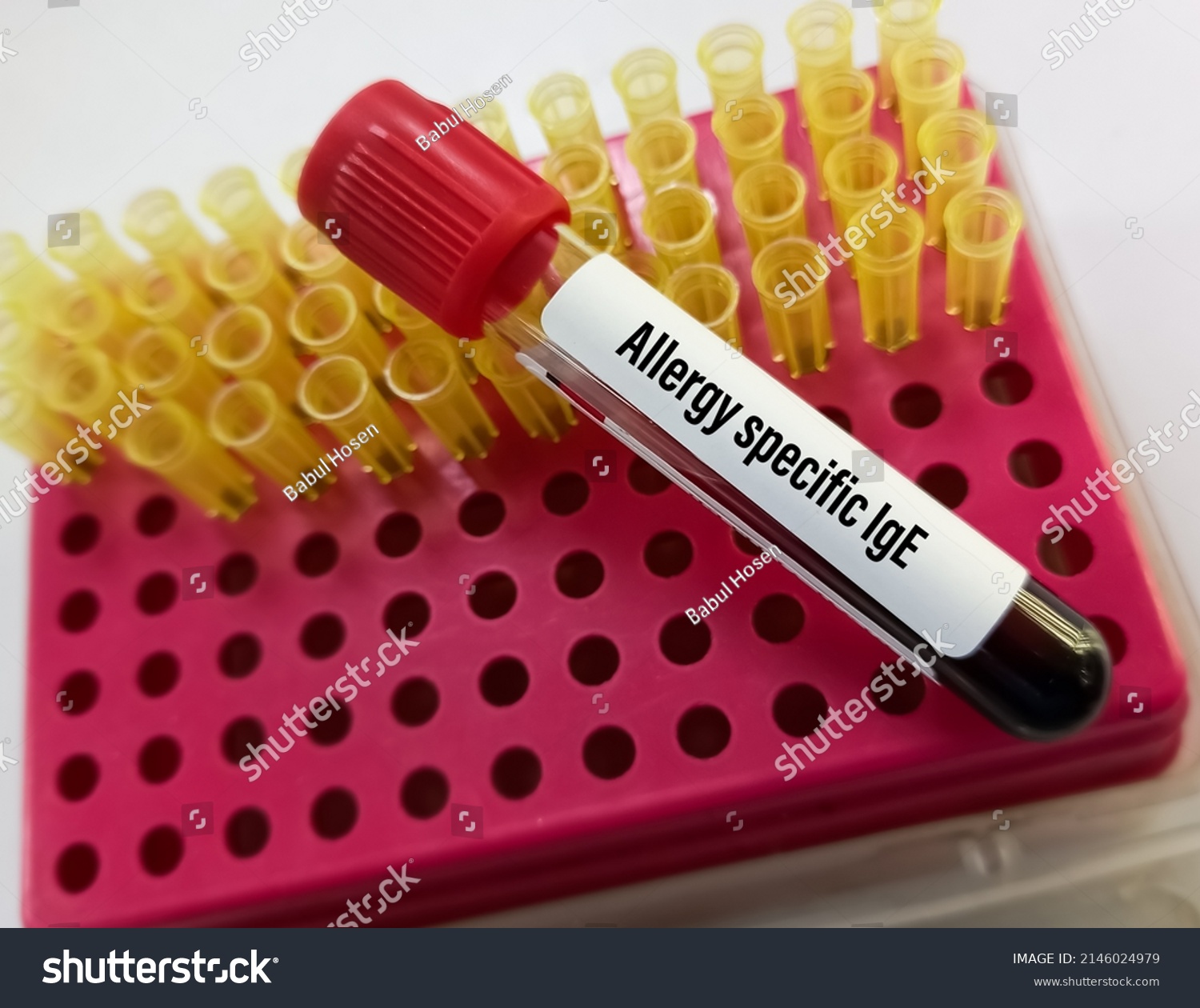 blood-sample-allergy-specific-ige-test-stock-photo-2146024979