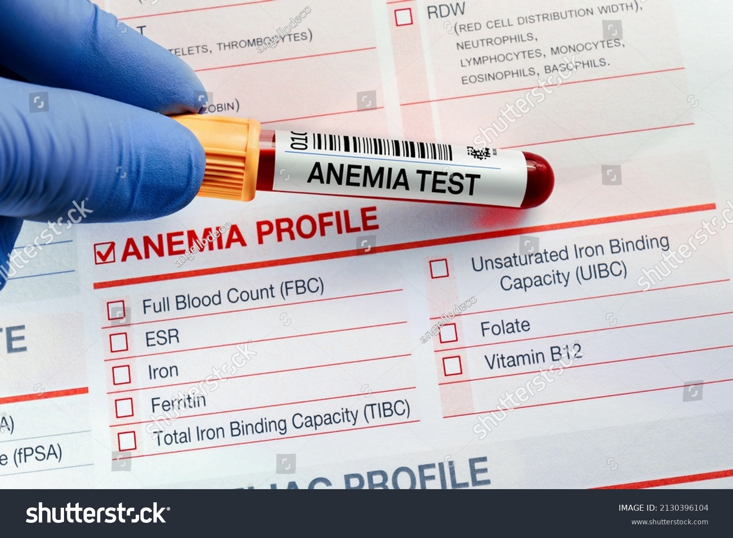 Blood Sample Analysis Anemia Profile Test Nh C S N2130396104   Stock Photo Blood Sample For Analysis Of Anemia Profile Test In Laboratory Doctor Holding Blood Tube Test With 2130396104 