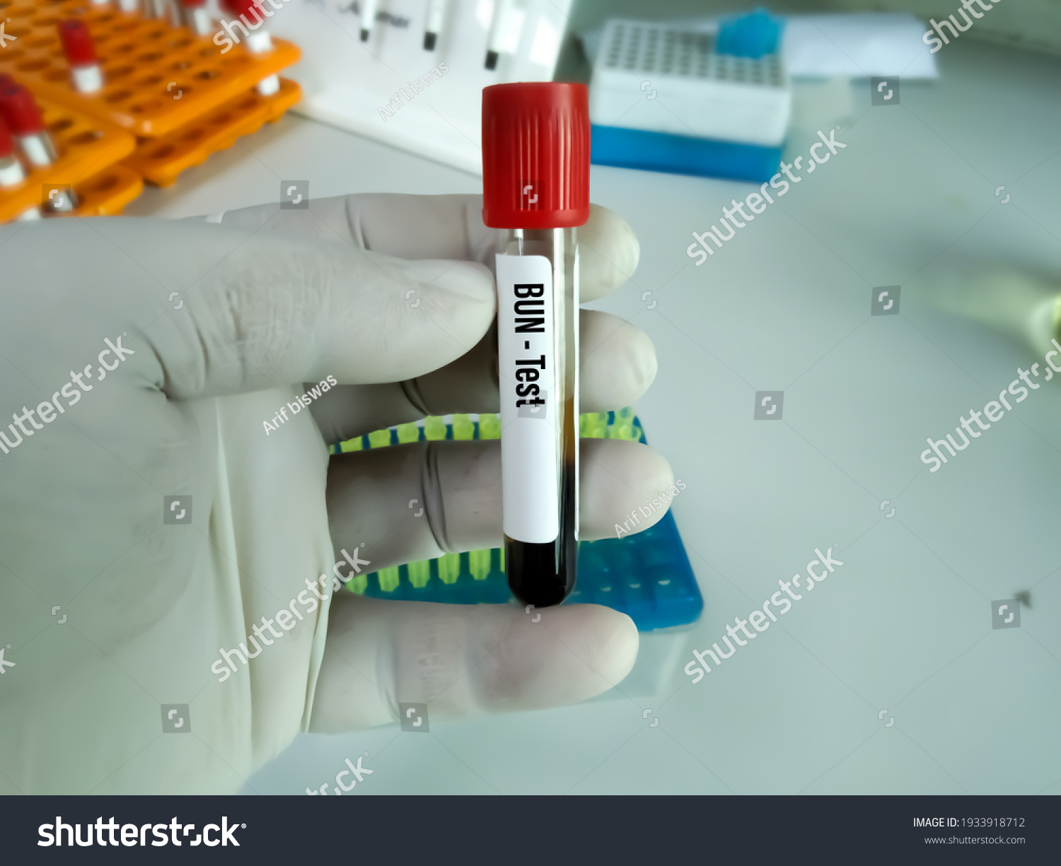 Blood Sample Bun Blood Urea Nitrogen Stock Photo 1933918712 | Shutterstock