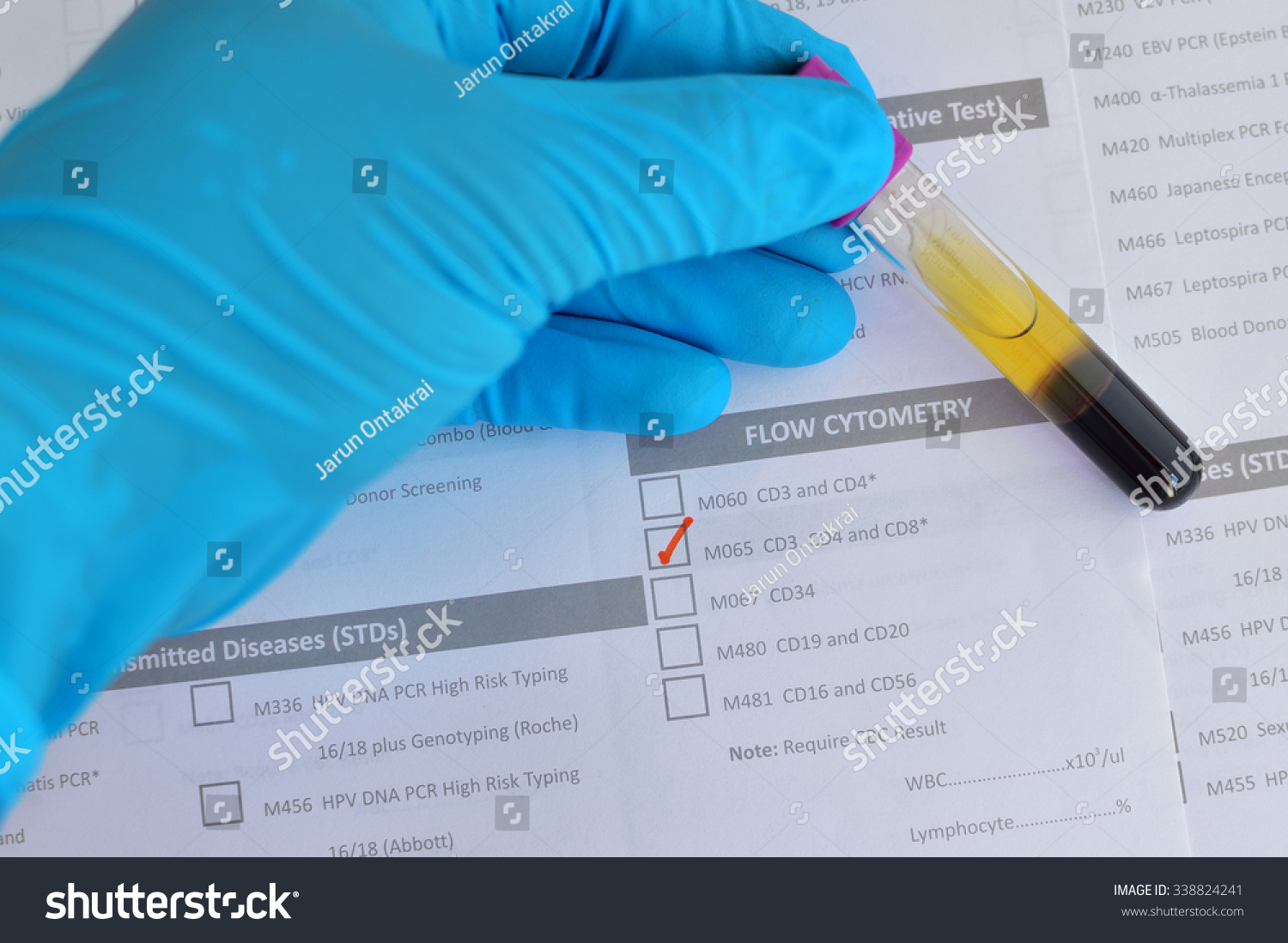 Blood Sample Cd3 Cd4 Cd8 Testing Stock Photo 338824241 | Shutterstock
