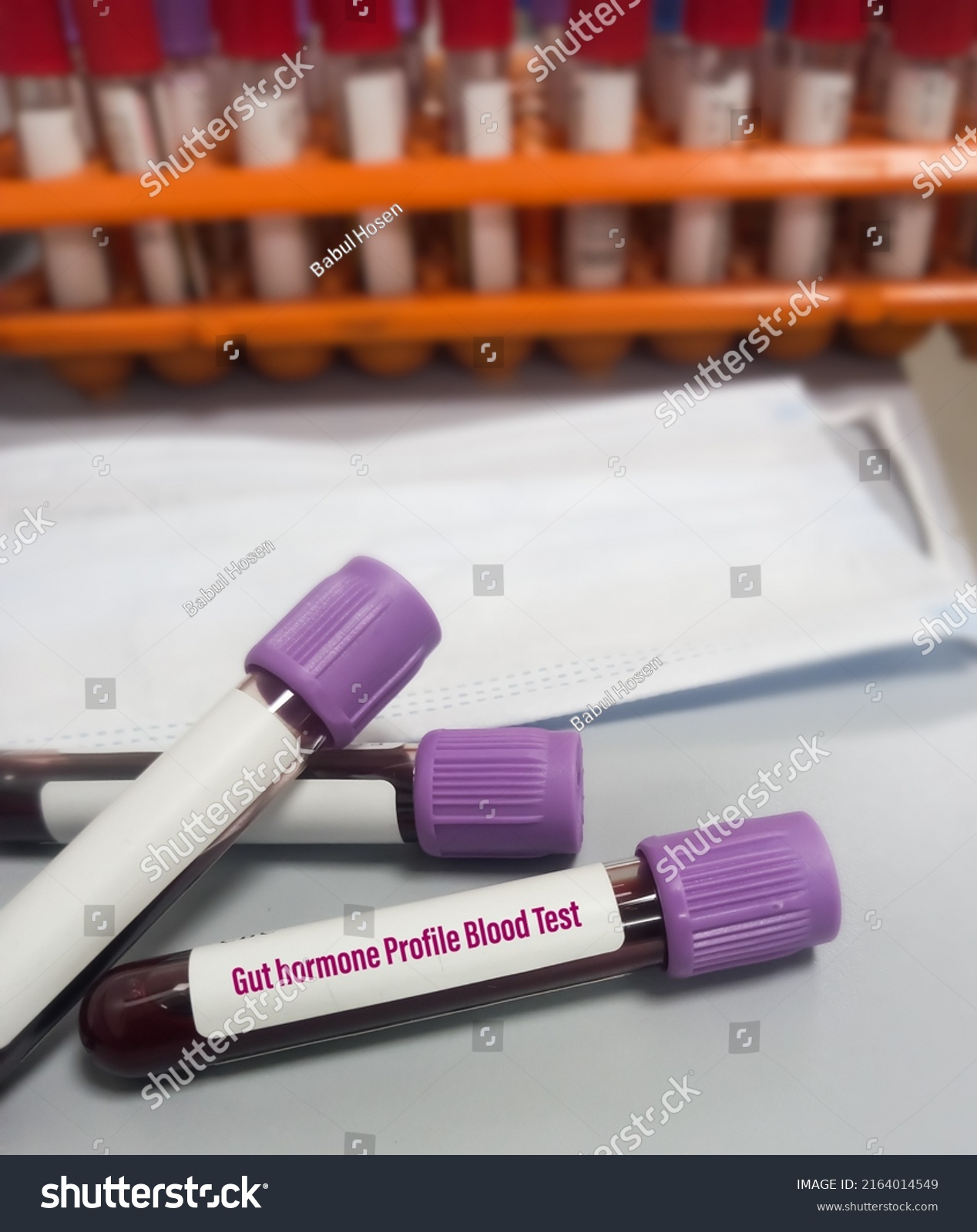 Blood Sample Gut Hormone Profile Blood Stock Photo 2164014549 ...