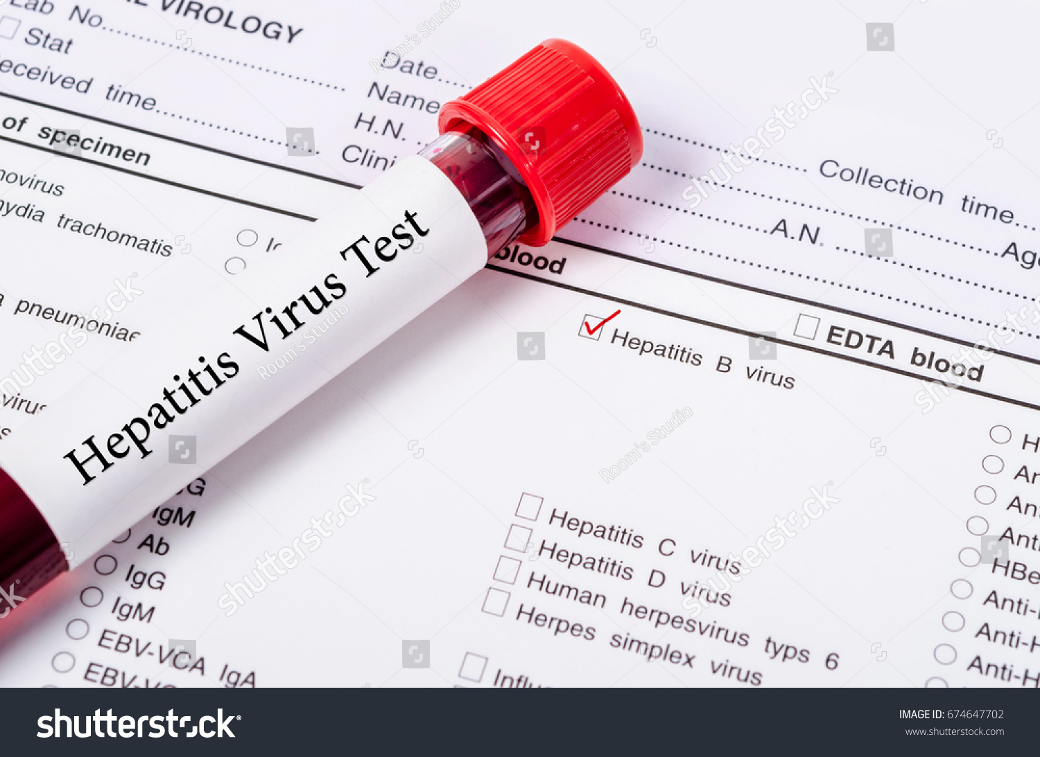 Blood test for hepatitis Blood test for hepatitis