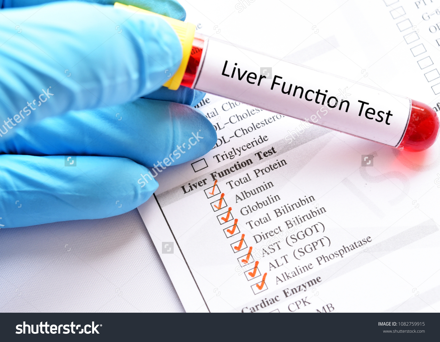 987 Liver Function Tests Images Stock Photos Vectors Shutterstock 987 Liver Function Tests Images Stock Photos Vectors Shutterstock