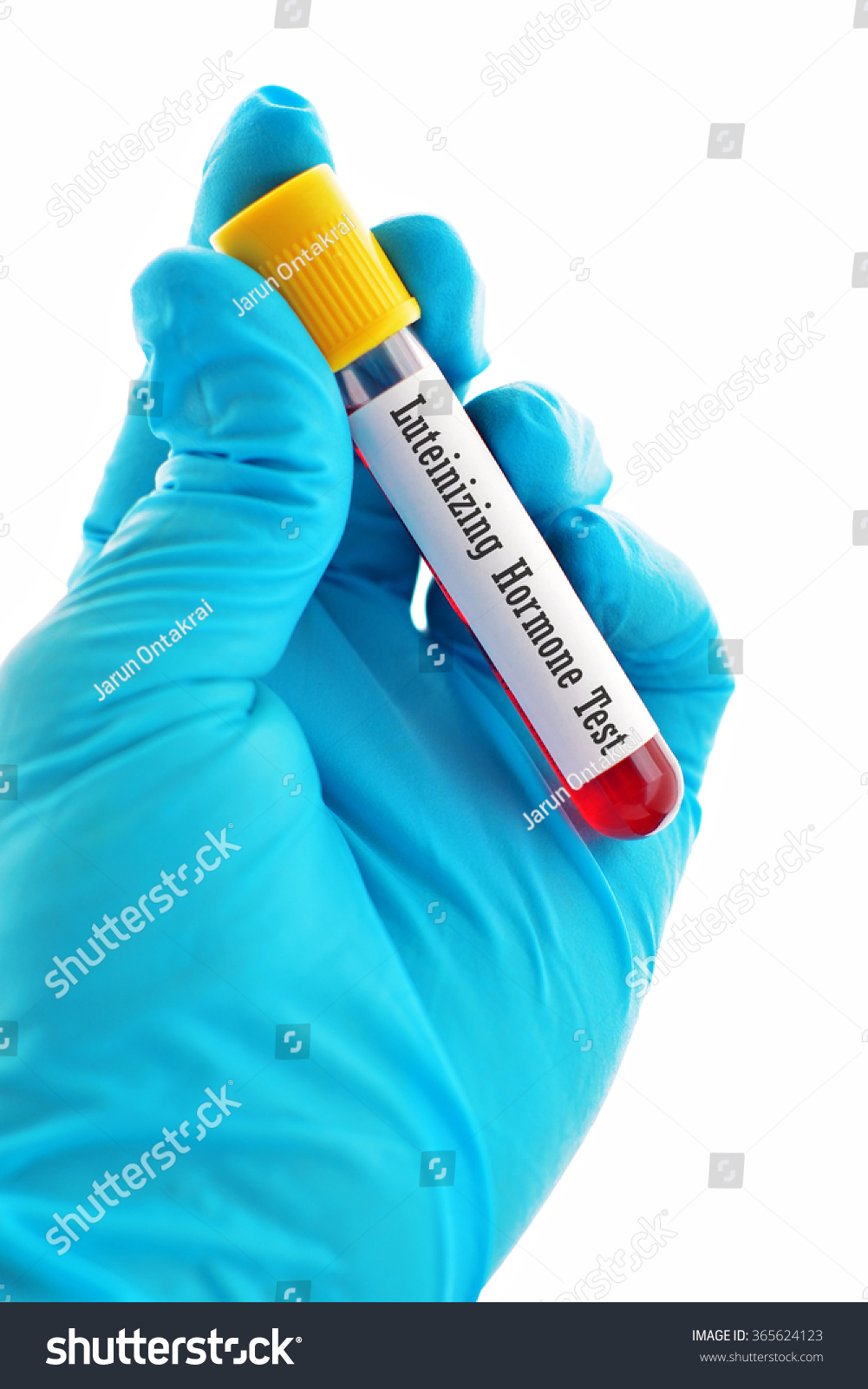 Estradiol Blood Testing