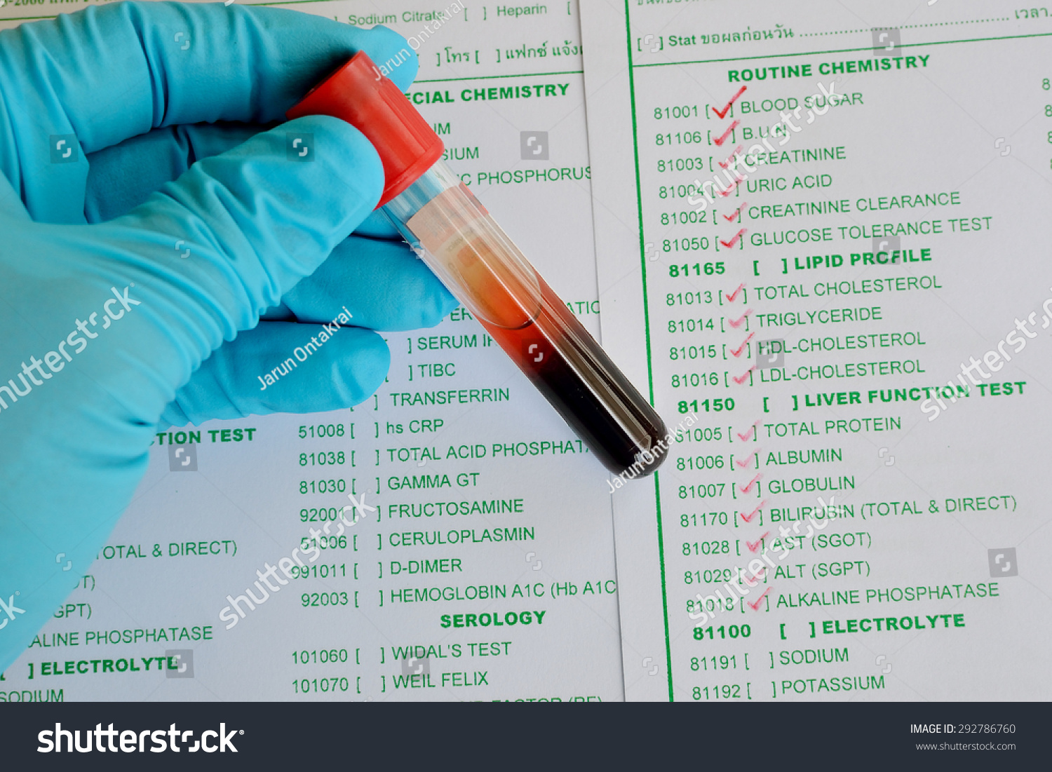 an analysis of the clinical chemistry test in medicine Laboratory tests help doctors determine what is going on within your body (national library of medicine) also in spanish laboratory tests (food and drug administration) (american association for clinical chemistry) coping with test pain, discomfort. an analysis of the clinical chemistry test in medicine Laboratory tests help doctors determine what is going on within your body (national library of medicine) also in spanish laboratory tests (food and drug administration) (american association for clinical chemistry) coping with test pain, discomfort.