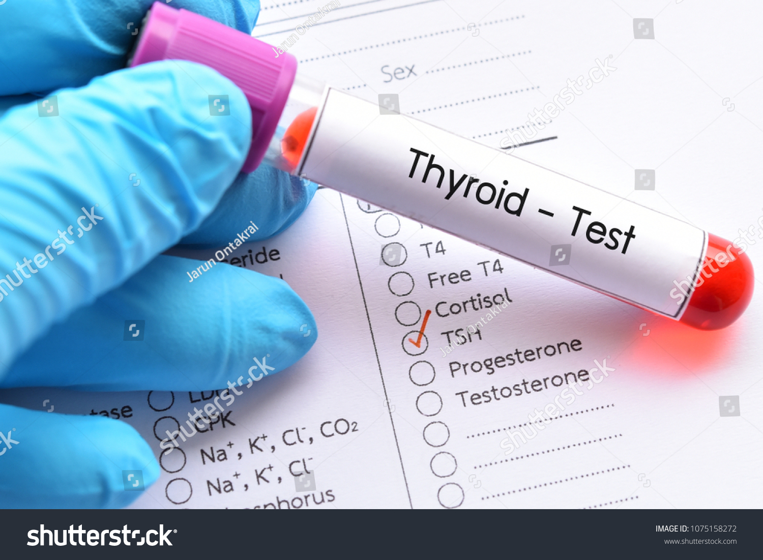 tsh-test