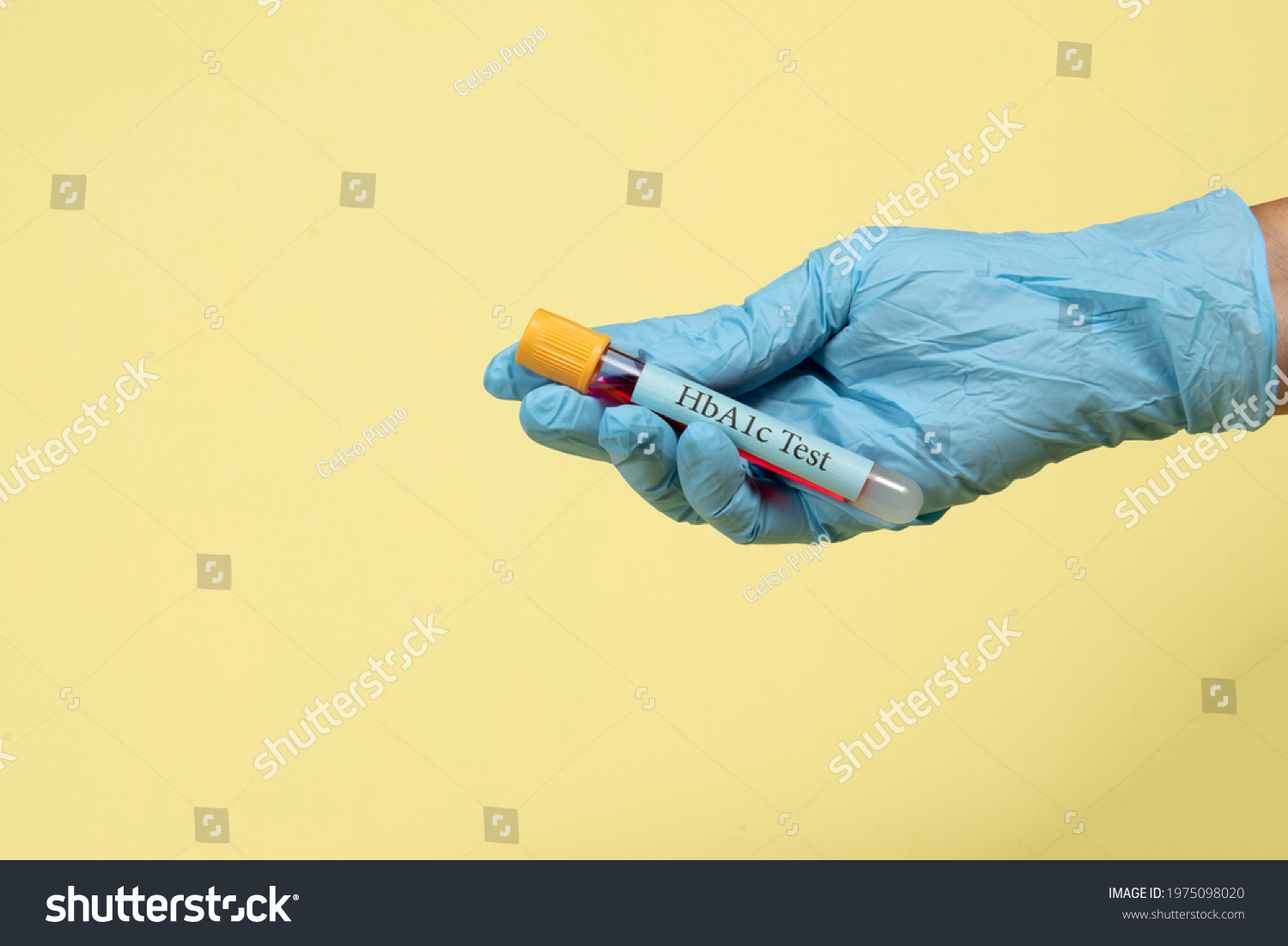 blood-sample-vacuum-tube-hemoglobin-hba1c-stock-photo-1975098020