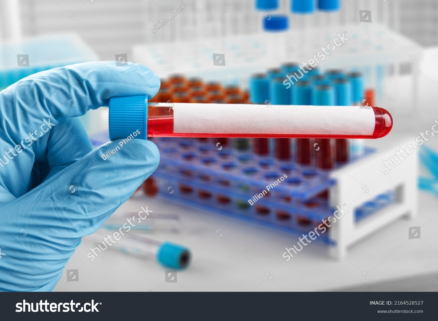 Blood Sample Patient Test Laboratory Doctor Stock Photo 2164528527 ...