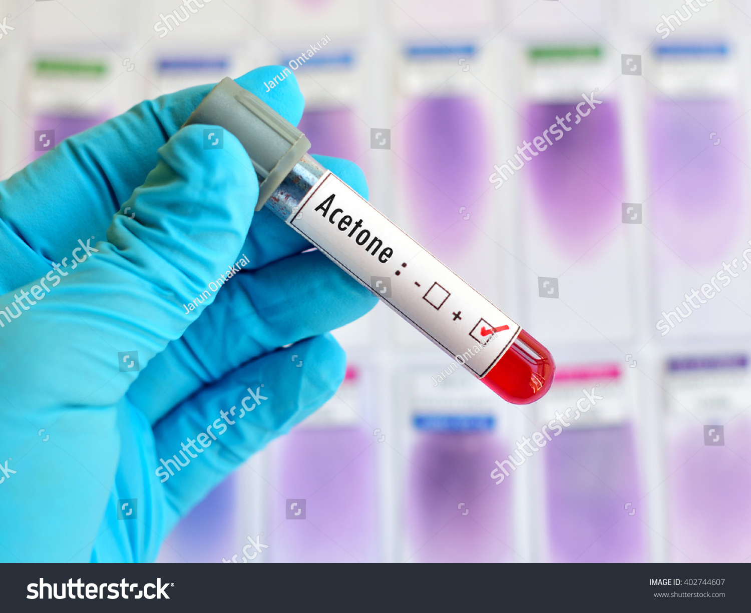 Blood Sample Positive Acetone Chemical Testing Stock Photo 402744607 ...